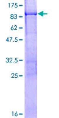 SDS-PAGE: Recombinant Human Cytokeratin, HMW GST (N-Term) Protein [H00051350-P01]