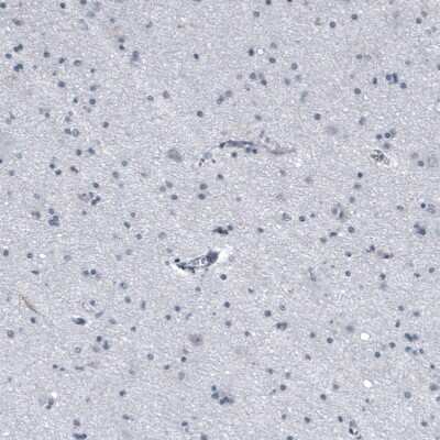 Immunohistochemistry-Paraffin: Cytokeratin, LMW Antibody [NBP1-93559]