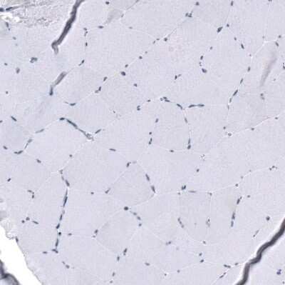 Immunohistochemistry-Paraffin: Cytokeratin, LMW Antibody [NBP1-93559]