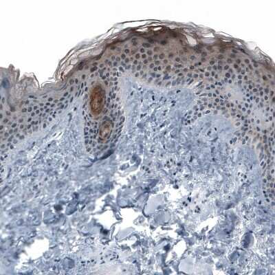 Immunohistochemistry-Paraffin: Cytokeratin, LMW Antibody [NBP1-93559]