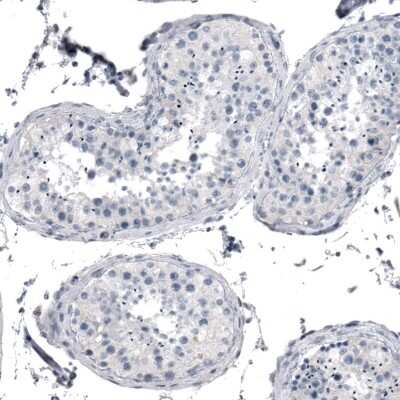 Immunohistochemistry-Paraffin: Cytokeratin, LMW Antibody [NBP1-93559]