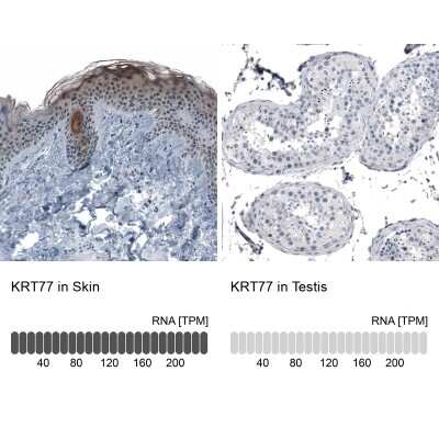 Immunohistochemistry-Paraffin: Cytokeratin, LMW Antibody [NBP1-93559]