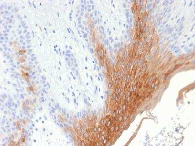 Immunohistochemistry-Paraffin: Cytokeratin 10 Antibody (KRT10/1990R) - Azide and BSA Free [NBP2-75768]