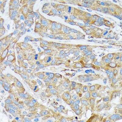 Immunohistochemistry-Paraffin: Cytokeratin 1 Antibody (10W8J6) [NBP3-16883]