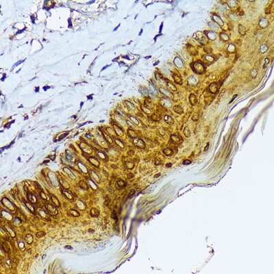 Immunohistochemistry-Paraffin: Cytokeratin 1 Antibody (10W8J6) [NBP3-16883]