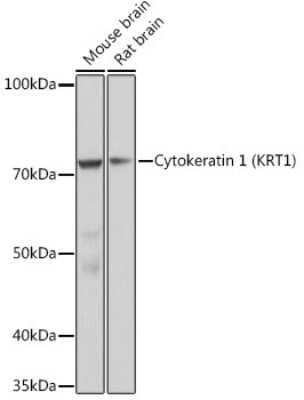 Western Blot: Cytokeratin 1 Antibody (10W8J6) [NBP3-16883]