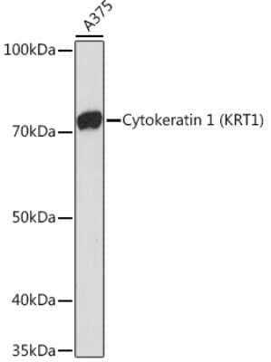 Western Blot: Cytokeratin 1 Antibody (10W8J6) [NBP3-16883]