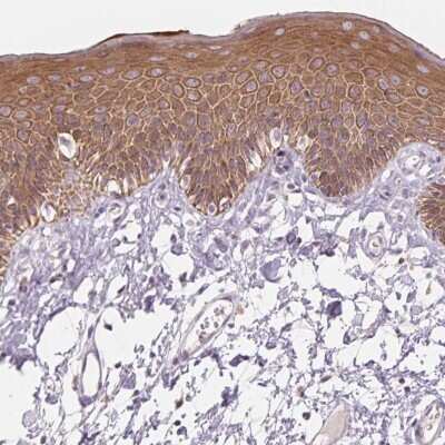 Immunohistochemistry: Cytokeratin 1 Antibody [NBP2-49378]