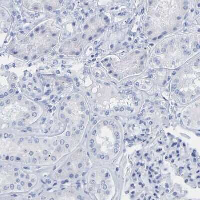 Immunohistochemistry-Paraffin: Cytokeratin 1 Antibody [NBP1-87956]