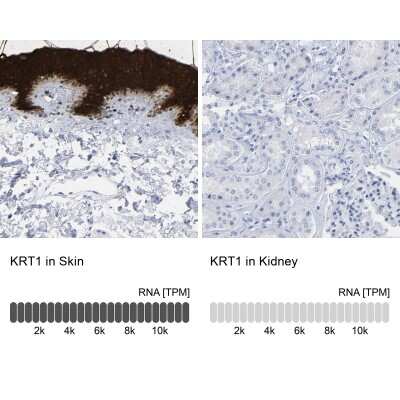 Immunohistochemistry-Paraffin: Cytokeratin 1 Antibody [NBP1-87956]