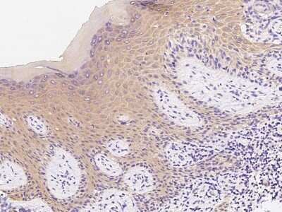 Immunohistochemistry-Paraffin: Cytokeratin 1 Antibody [NBP2-98734]