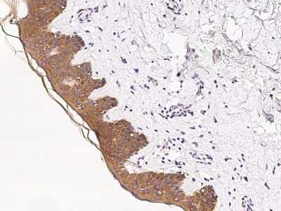 Immunohistochemistry-Paraffin: Cytokeratin 1 Antibody [NBP2-98734]