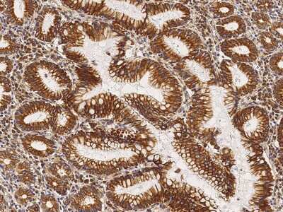 Immunohistochemistry-Paraffin: Cytokeratin 1 Antibody [NBP2-98734]