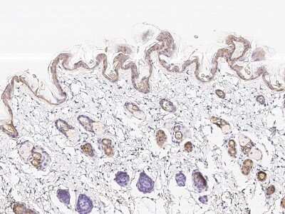 Immunohistochemistry-Paraffin: Cytokeratin 1 Antibody [NBP2-98734]
