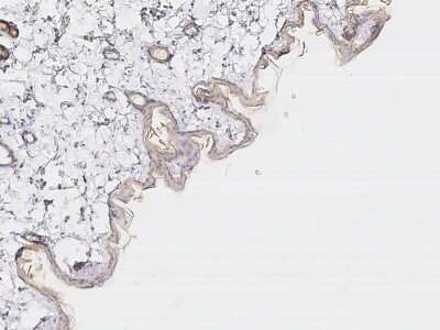 Immunohistochemistry-Paraffin: Cytokeratin 1 Antibody [NBP2-98734]