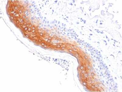 Immunohistochemistry-Paraffin: Cytokeratin 1 Antibody (KRT1/1840) - Azide and BSA Free [NBP3-08475]