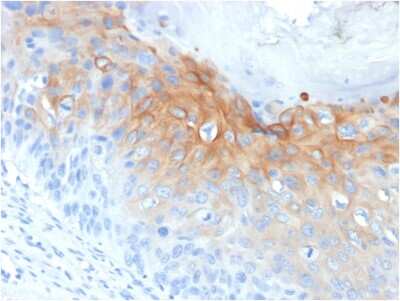 Immunohistochemistry-Paraffin: Cytokeratin 1 Antibody (KRT1/1840) - Azide and BSA Free [NBP3-08475]
