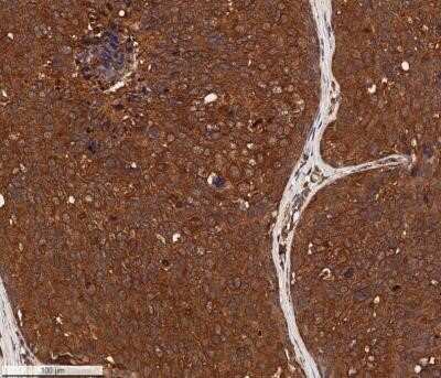 Immunohistochemistry-Paraffin: Cytokeratin 1 Antibody (LHK1) - Azide and BSA Free [NBP2-80688]