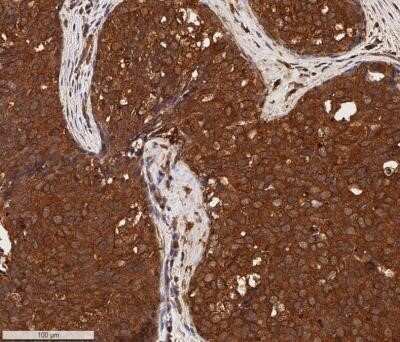 Immunohistochemistry-Paraffin: Cytokeratin 1 Antibody (LHK1) - Azide and BSA Free [NBP2-80688]