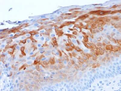 Immunohistochemistry-Paraffin: Cytokeratin 1 Antibody (LHK1) - Azide and BSA Free [NBP3-08474]