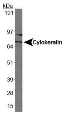 Western Blot: Cytokeratin 1 Antibody (LHK1)Azide and BSA Free [NBP2-80688]