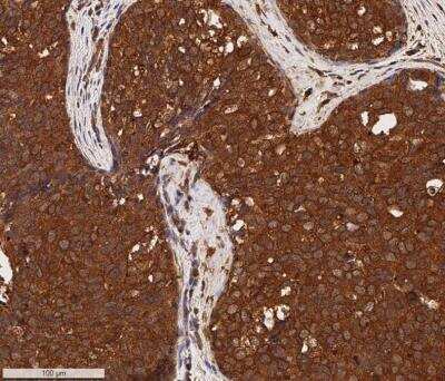 Immunohistochemistry-Paraffin: Cytokeratin 1 Antibody (LHK1) - BSA Free [NB100-2756]
