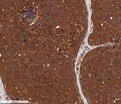 Immunohistochemistry-Paraffin: Cytokeratin 1 Antibody (LHK1) - BSA Free [NB100-2756]