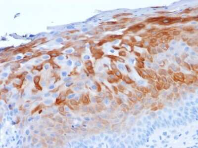 Immunohistochemistry-Paraffin: Cytokeratin 1 Antibody (LHK1) [NBP3-07775]