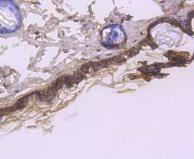 Immunohistochemistry-Paraffin: Cytokeratin 1 Antibody (SN72-08) [NBP2-67681]