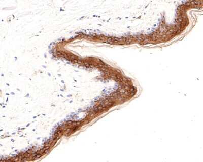 Immunohistochemistry-Paraffin: Cytokeratin 1 Antibody (SN72-08) [NBP2-67681]