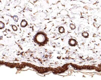 Immunohistochemistry-Paraffin: Cytokeratin 1 Antibody (SN72-08) [NBP2-67681]