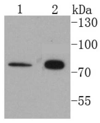 Western Blot: Cytokeratin 1 Antibody (SN72-08) [NBP2-67681]