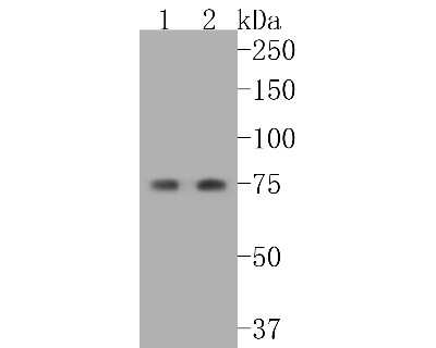 Western Blot: Cytokeratin 1 Antibody (SN72-08) [NBP2-67681]