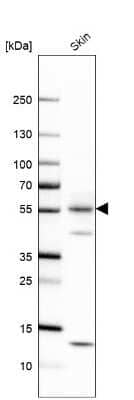 Western Blot: Cytokeratin 1 Antibody [NBP2-49378]