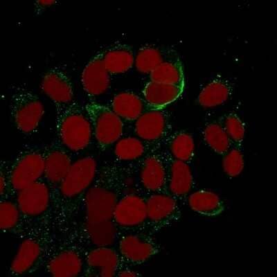 Immunocytochemistry/ Immunofluorescence: Cytokeratin 10/13 Antibody (DE-K13) [NBP2-45256]