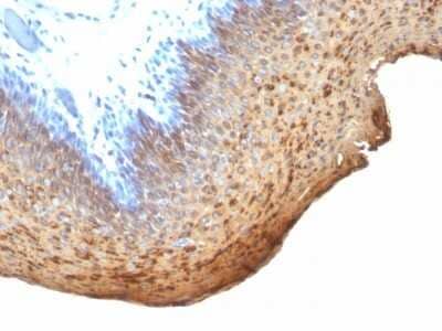 Immunohistochemistry-Paraffin: Cytokeratin 10/13 Antibody (DE-K13) [NBP2-45256]