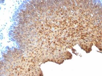 Immunohistochemistry-Paraffin: Cytokeratin 10/13 Antibody (SPM262) - IHC-Prediluted [NBP2-48041]