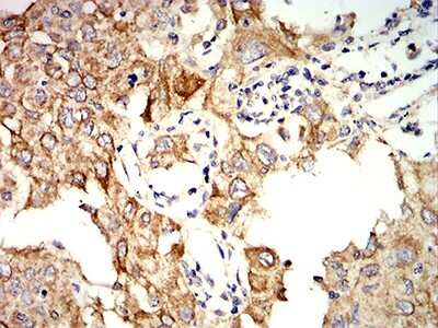 Immunohistochemistry: Cytokeratin 10 Antibody (1C3D9) - BSA Free [NBP2-61737]