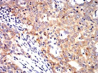 Immunohistochemistry-Paraffin: Cytokeratin 10 Antibody (3C2F5) - BSA Free [NBP2-61736]