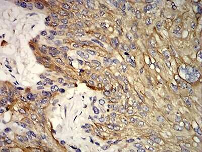 Immunohistochemistry-Paraffin: Cytokeratin 10 Antibody (3C2F5) - BSA Free [NBP2-61736]