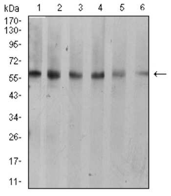 Western Blot: Cytokeratin 10 Antibody (3C2F5)BSA Free [NBP2-61736]