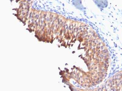 Immunohistochemistry-Paraffin: Cytokeratin 10 Antibody (DE-K10) [NBP2-47650]