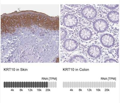 Immunohistochemistry-Paraffin: Cytokeratin 10 Antibody [NBP1-85604]