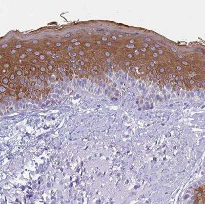 Immunohistochemistry-Paraffin: Cytokeratin 10 Antibody [NBP1-85604]