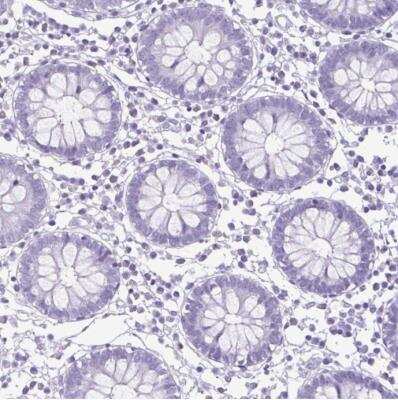 Immunohistochemistry-Paraffin: Cytokeratin 10 Antibody [NBP1-85604]