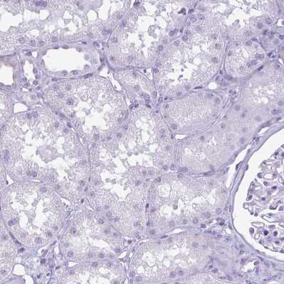 Immunohistochemistry-Paraffin: Cytokeratin 10 Antibody [NBP1-85604]