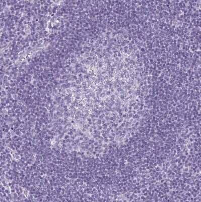 Immunohistochemistry-Paraffin: Cytokeratin 10 Antibody [NBP1-85604]