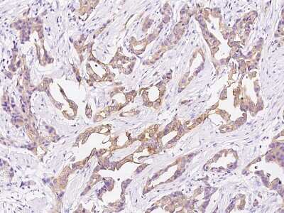 Immunohistochemistry-Paraffin: Cytokeratin 10 Antibody [NBP2-99090]