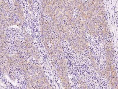 Immunohistochemistry-Paraffin: Cytokeratin 10 Antibody [NBP2-99090]