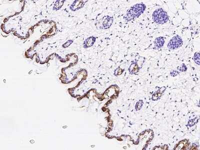 Immunohistochemistry-Paraffin: Cytokeratin 10 Antibody [NBP2-99090]